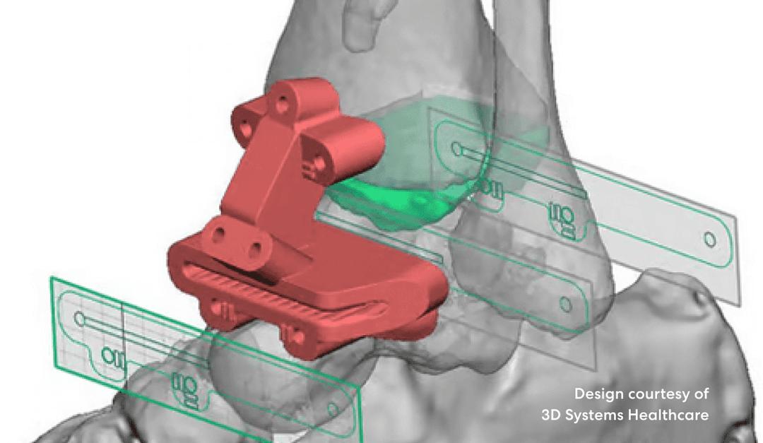 Unconstrained modelling